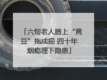 六旬老人唇上“黄豆”拖成癌 四十年烟瘾埋下隐患